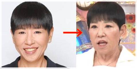 【動画まとめ】 和田 アキ子 顔 変わっ た 話題のSns投稿まとめ 2026 #692