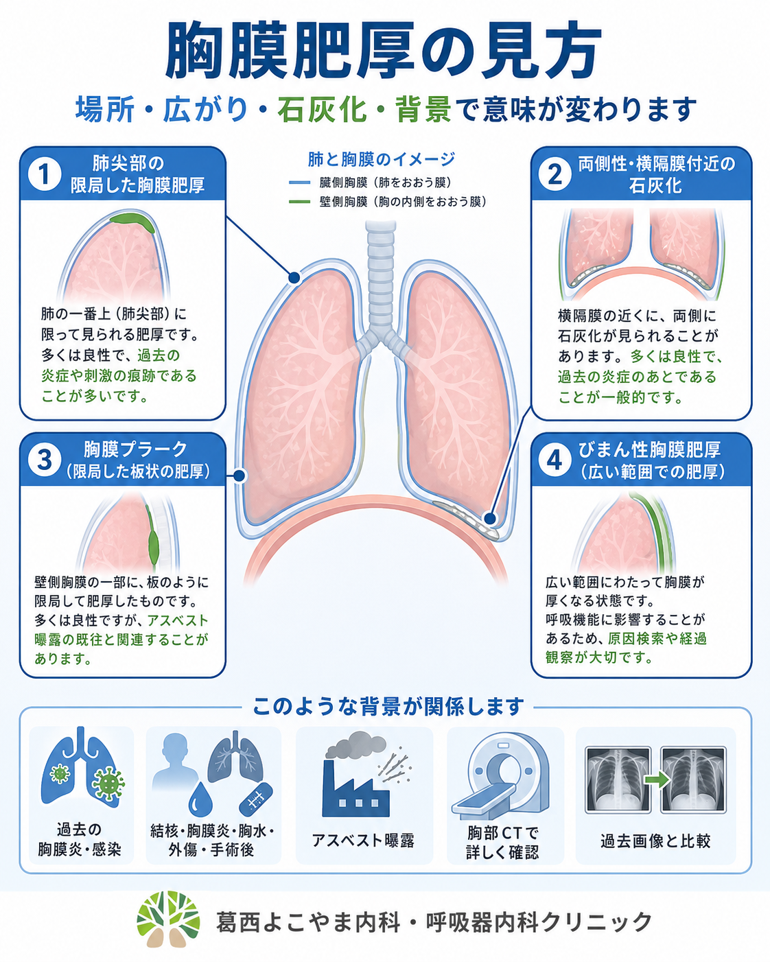 健診の「胸膜肥厚」は放置危険？肺がん・アスベストとの真相と対処法