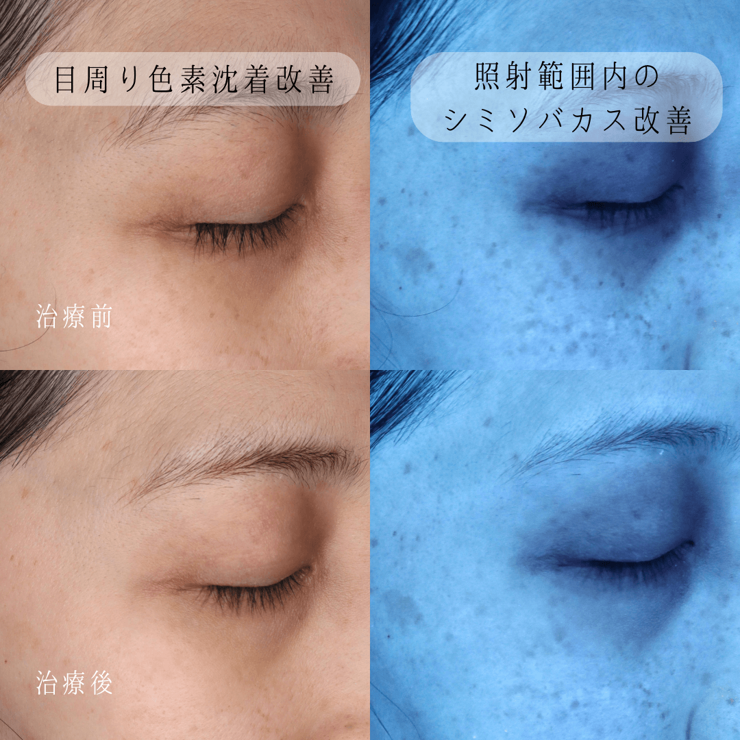 下がり天井の間接照明で後悔ゼロへ！失敗防ぐ寸法の基準と費用相場