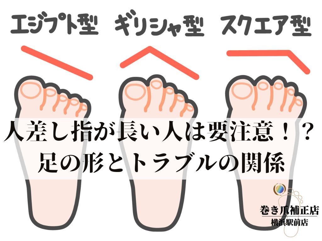 足の人差し指が長い人の特徴｜親より出世する噂とギリシャ型の真実