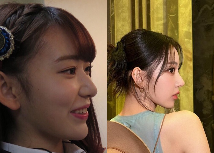 宮脇咲良の整形疑惑を徹底検証！昔の画像と現在で迫る顔変化の真相