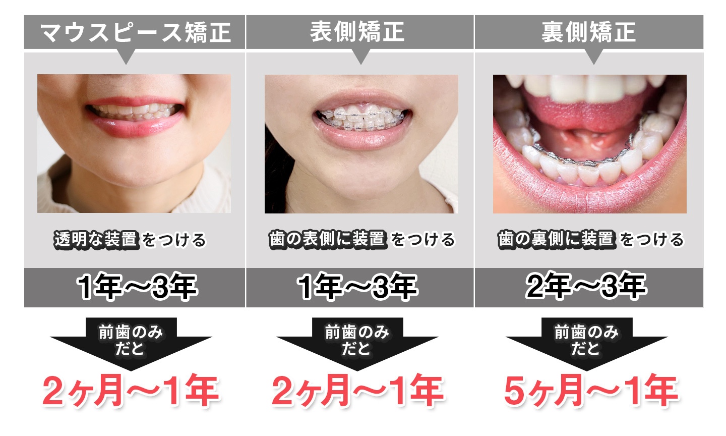 マウスピース矯正で顔が変わる？輪郭・Eライン変化の真相と後悔防止策