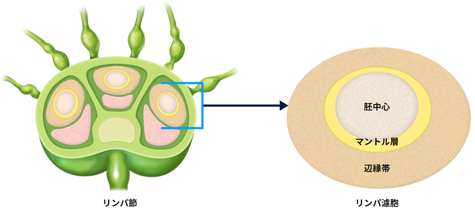 びまん性大細胞型B細胞リンパ腫は本当に完治できる？最新治療と生存率を解説